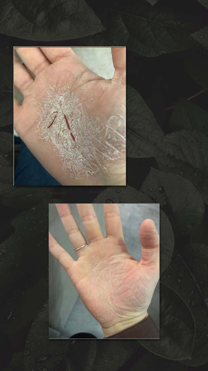 GRATIS PROEF ZALF - NATUURLIJK ZALFJE PSORIAS EN ECZEEM - HAIR AND NATURE