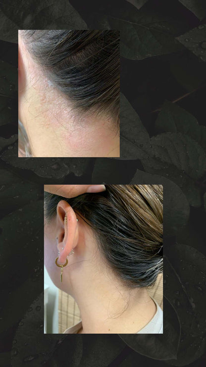 HAIR AND NATURE PSORIASIS &amp; ECZEMA TRIAL OINTMENT 10GRAM