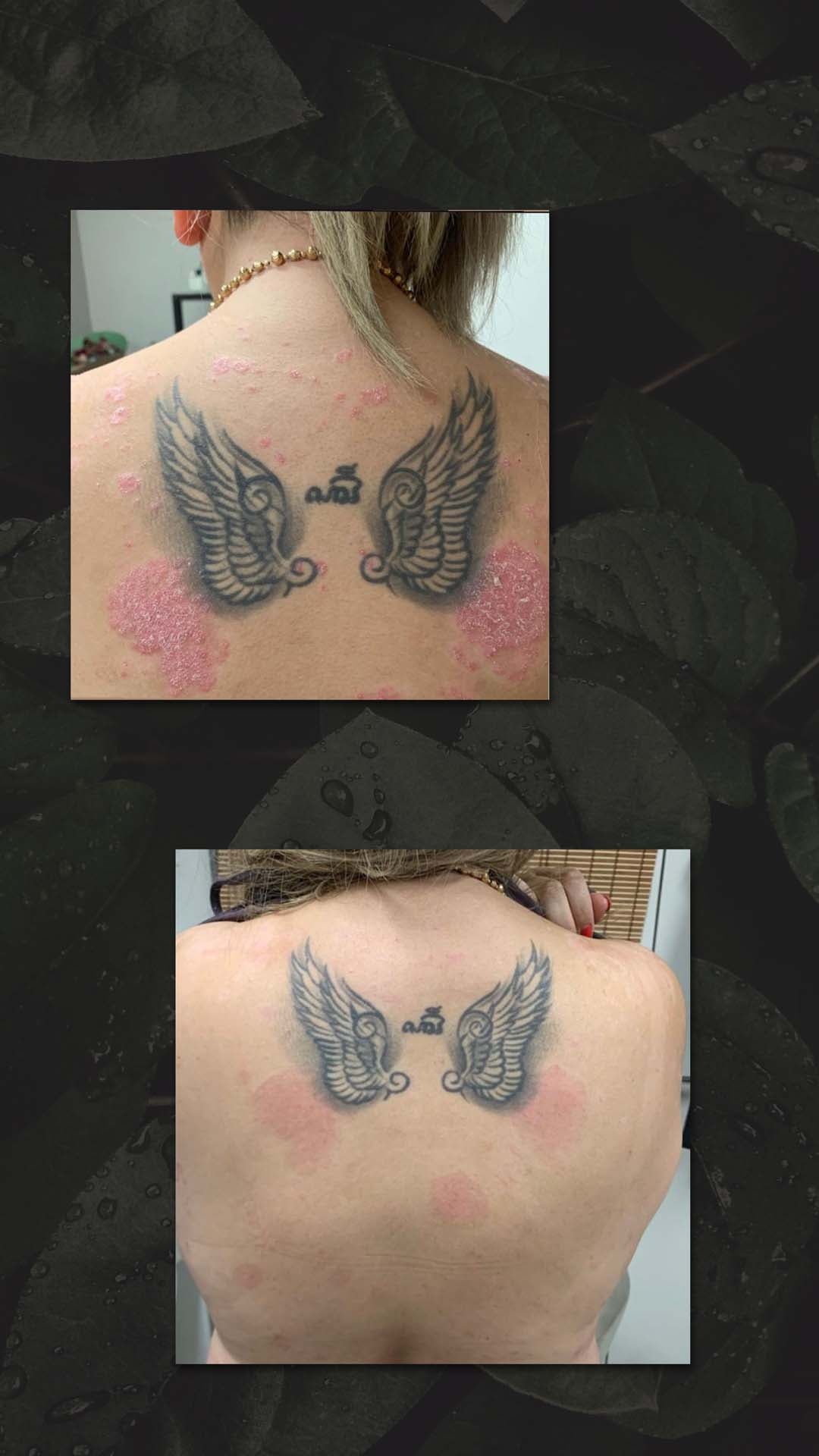 HAIR AND NATURE PSORIASIS &amp; ECZEMA TRIAL OINTMENT 10GRAM